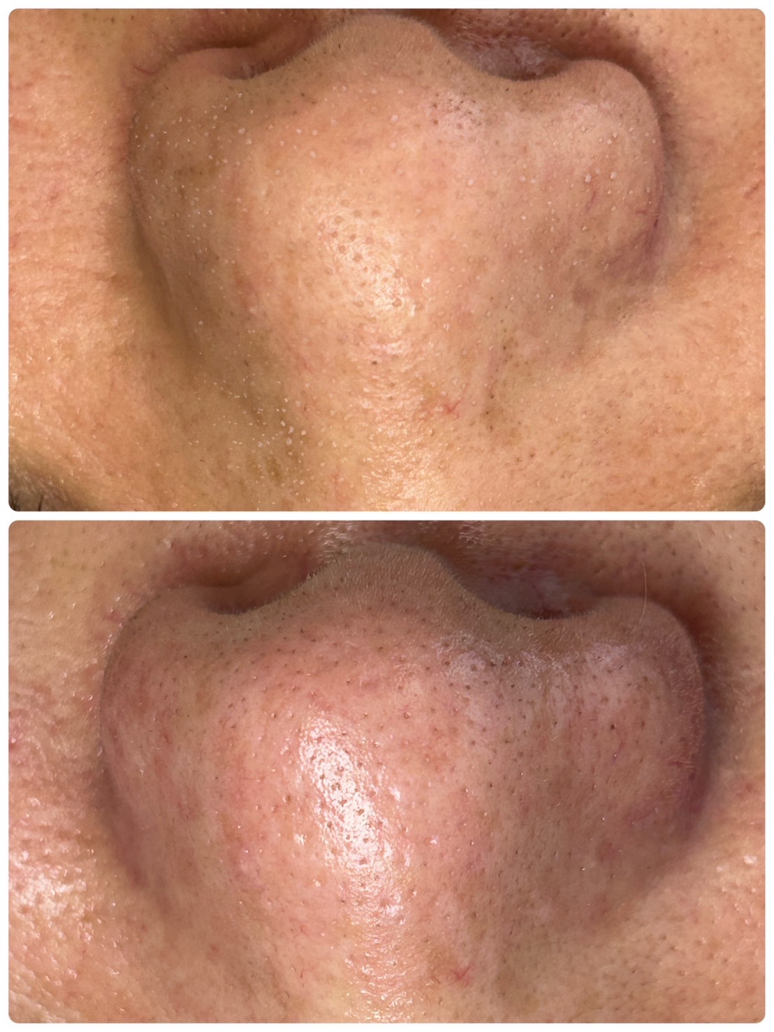 facial